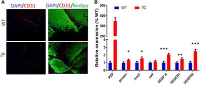 Overexpression of Pregnancy Zone Protein in Fat Antagonizes Diet-Induced Obesity Under an Intermittent Fasting Regime